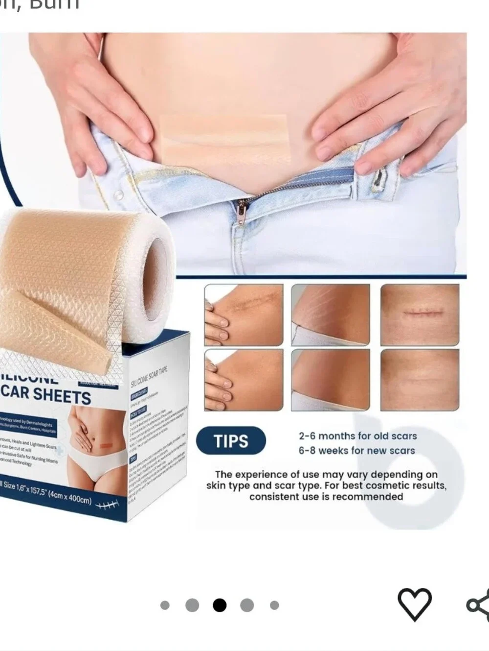 Silicone Scar Sheet